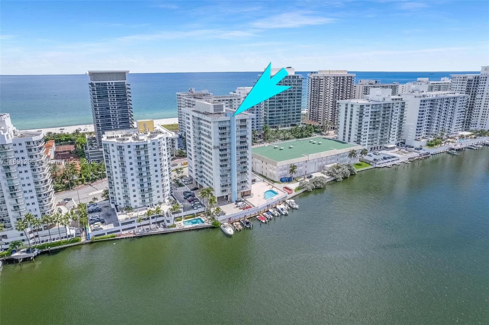 5838 Collins Ave 11B photo 4