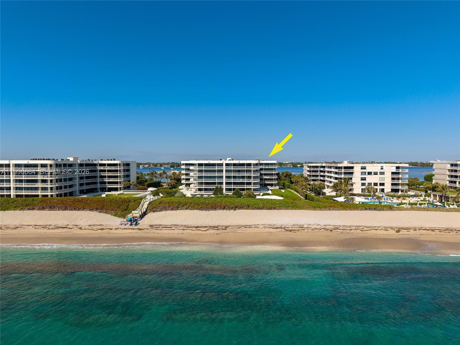 3300 S Ocean Blvd 207N photo 25