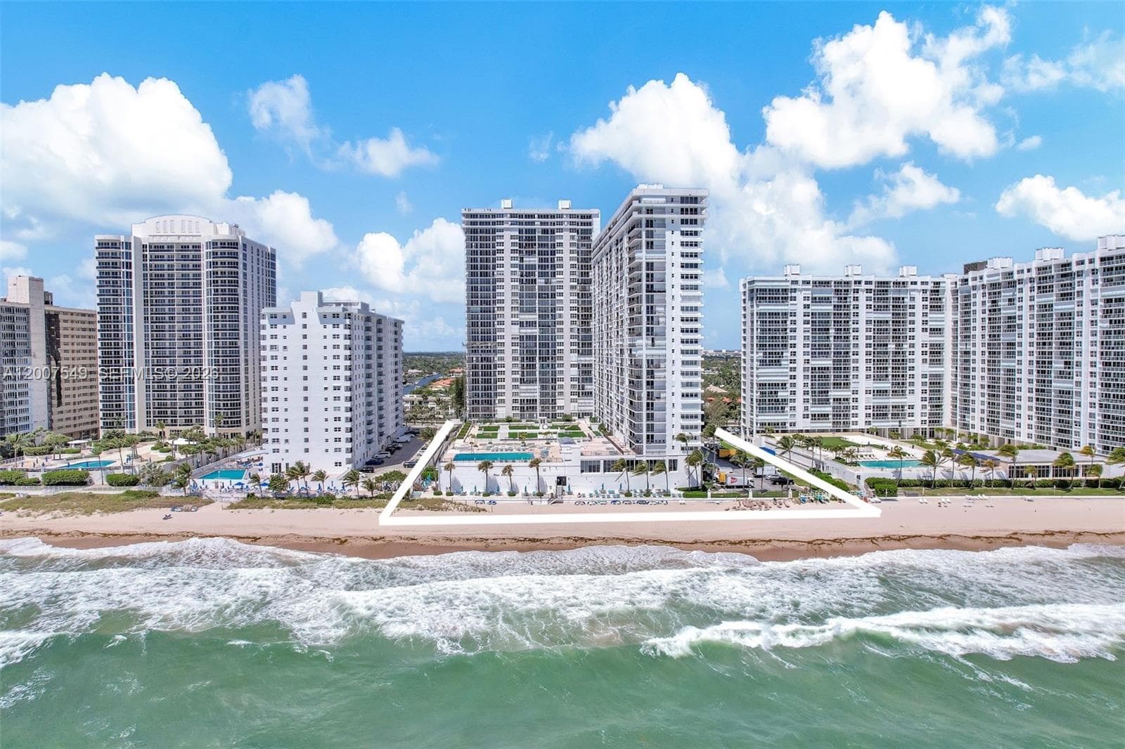 4280 Galt Ocean Dr 2F photo 1